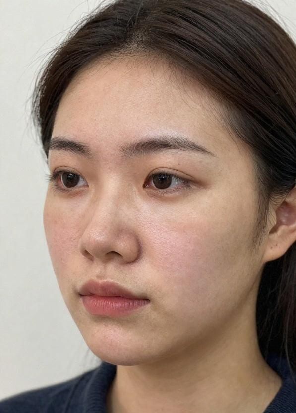 After